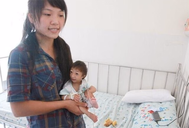 Hình hài nhỏ bé và khác lạ của Tiểu Tiểu ngay từ khi mới lọt lòng