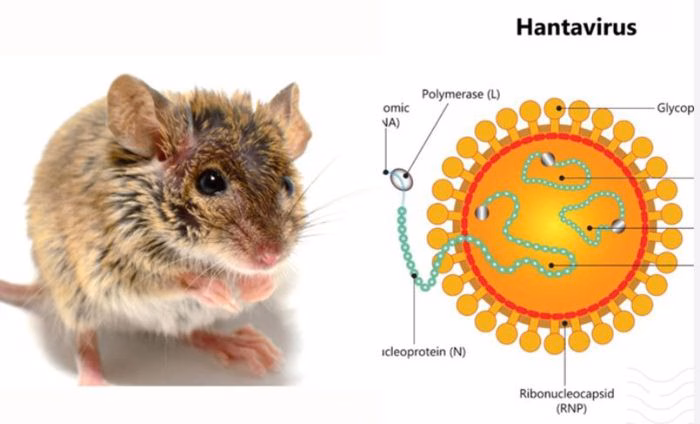Hantavirus có thể tiến triển từ triệu chứng nhẹ sang suy đa tạng chỉ trong thời gian ngắn